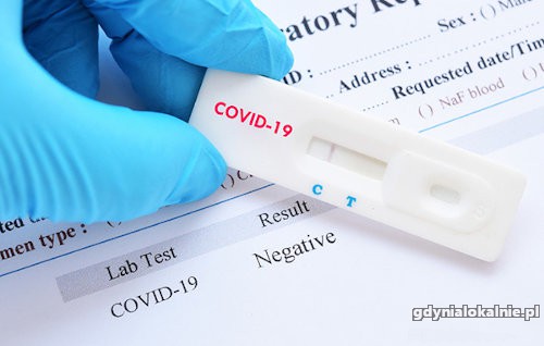 Negatywny test Covid-19 lub zaświadczenie o szczepieniu z wpisem do IKP